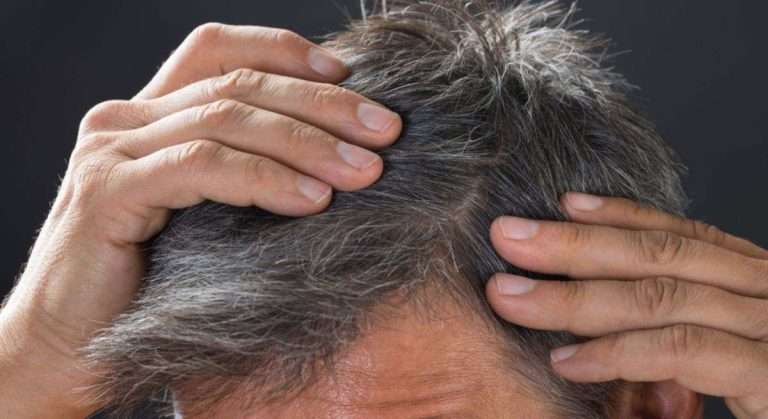 Hábitos que ayudan a retrasar la aparición de canas